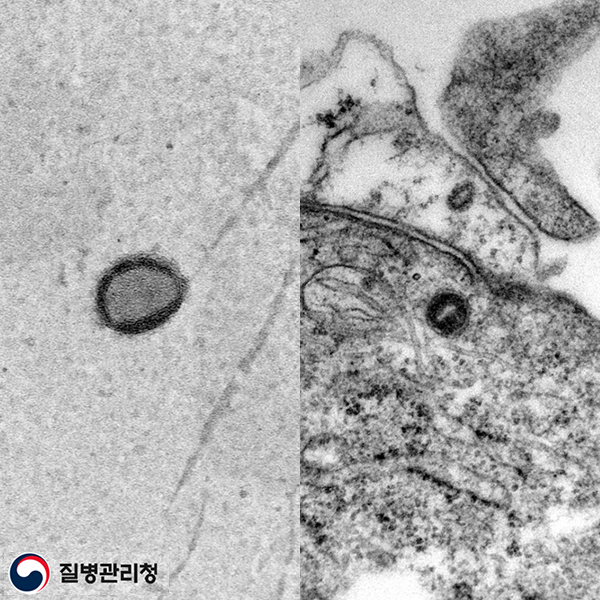 Monkeypox virus(엠폭스)