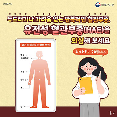 두드러기나 가려움 없는 반복적인 혈관부종, 유전성 혈관부종(HAE)을 의심해 보세요